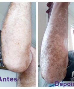 Alternative view of Para auxiliar nos cuidados da pele com vitiligo 4 Potes Creme Renovação Celular 60gr cada + 120 Caps mama cadela