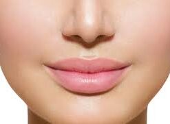 Gloss para Lábios com vitiligo - 8 ml - Auxilia na hidratação e Pigmentação