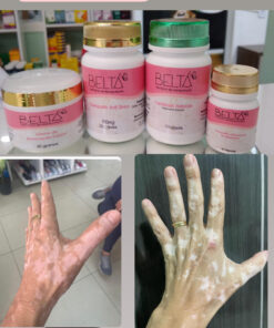1 creme renovação celular + 120 caps Carotenos + 120 caps anti stress + 60 caps estimulador de melanina (auxilia nos cuidados da pele com vitiligo)