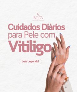Protocolo para auxiliar no tratamento da pele com  VITILIGO 2 MESES COM 7 PRODUTOS