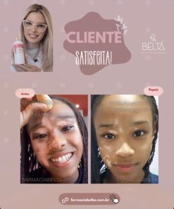 Protocolo   Infantil para auxiliar no tratamento da pele com vitiligo